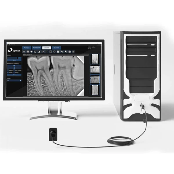 Eighteeth Nanopix Dental RVG Sensor - Image 4